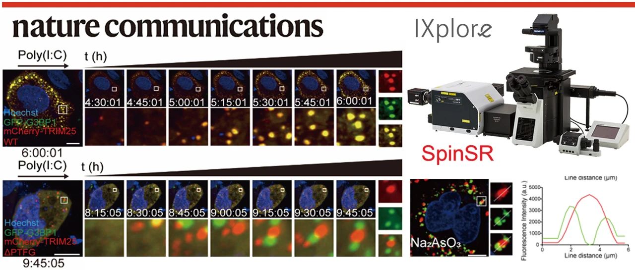 科(kē)技(jì)前沿 | EVIDENT共聚焦/超分(fēn)辨助力Nature Communications發文(wén)揭示應激顆粒亞型鑒定範式